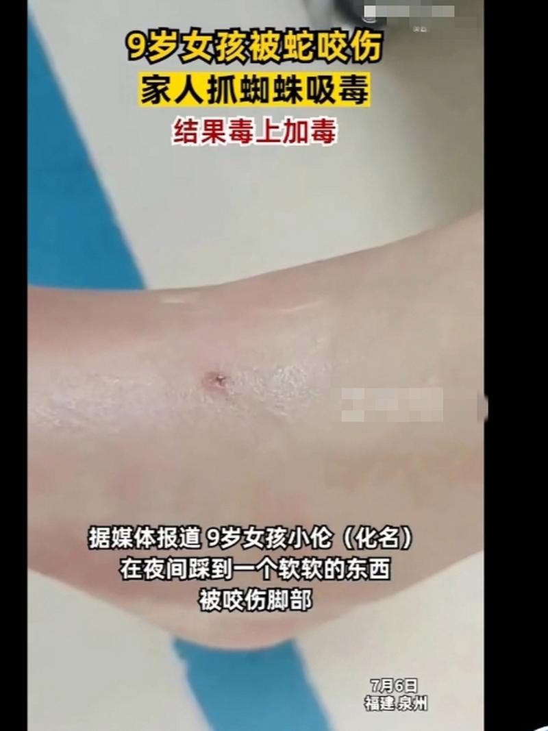 开奖澳门开奖结果+开奖记录表和被蛇咬反抓蛇再遭咬与被蛇咬反抓蛇再遭咬伤